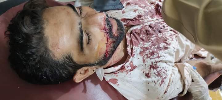 AKT__Sultan's tweet photo. پی ٹی آئی منچن آباد کے غنڈوں کا پاکستان مسلم لیگ نون کے ورکر فہیم پراچہ پر بے انتہاء تشدد چہرے پرکلہاڑی کا وار کیا جس سے اسکا ایک طرف چہرا خراب ہوگیا۔ بیچارے کی حالت تشویشناک بتائی جارہی ہیں
جبکہ حملہ آوروں کے خلاف کوئی بھی کاروائی عمل میں نہی لائی گئ ہے
@TararAttaullah Plz Sir https://t.co/HCBIRL4ks7