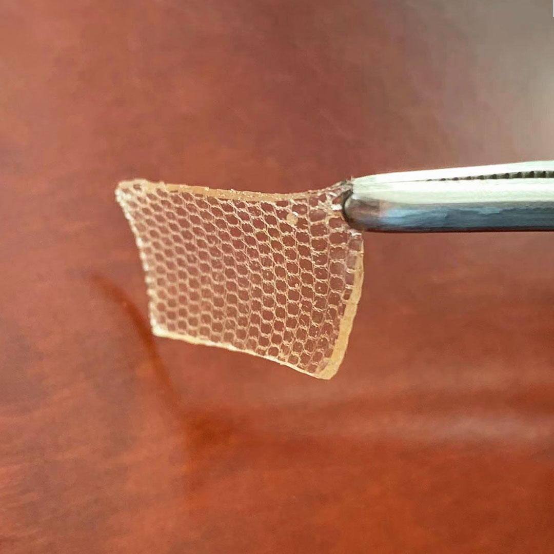 #OneHealth #onehealth 
😍😍It's like a delicate work of art.
 #art  #honeycomb  #wounddressing #wound #woundcare #woundhealing