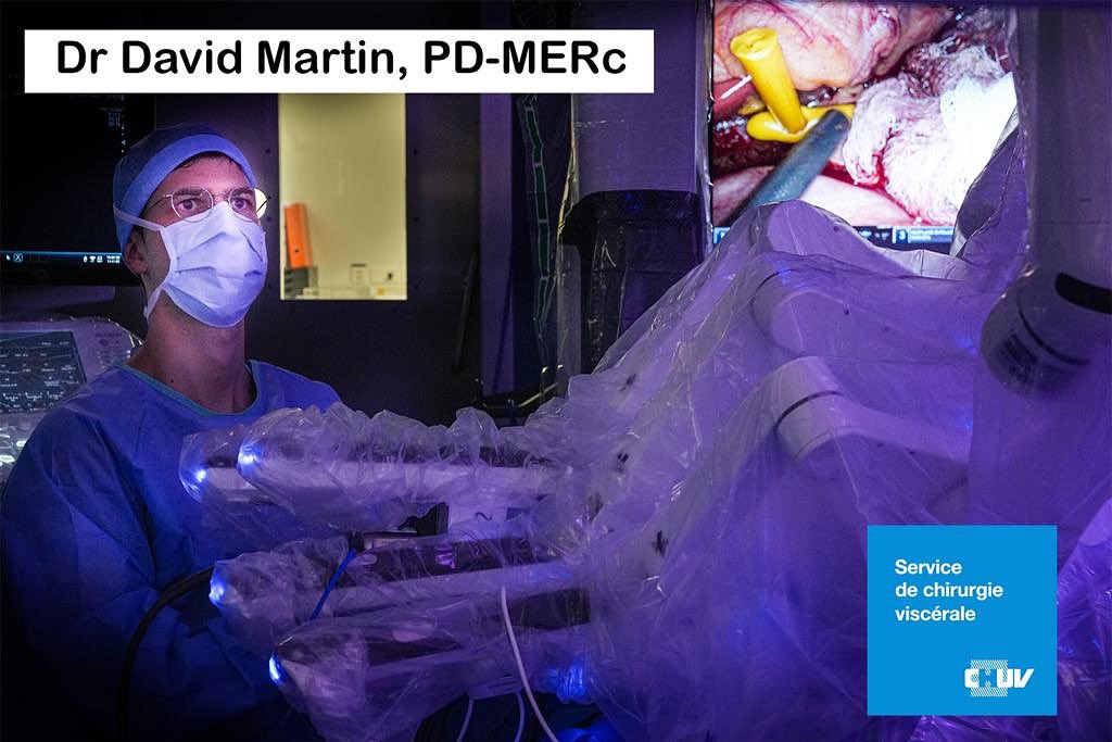VisceralChuv's tweet photo. Congratulations Dr David Martin for your recent PD &amp; MERc nomination @unil @CHUVLausanne and for obtaining a clinical fellowship position in HPB and Transplant Surgery @RIE_Lothian, UK.

 #ilovesurgery #hpbsurgery @BJSAcademy @ProfDemartines
@VisceralChuv https://t.co/oSh7DuDv9N