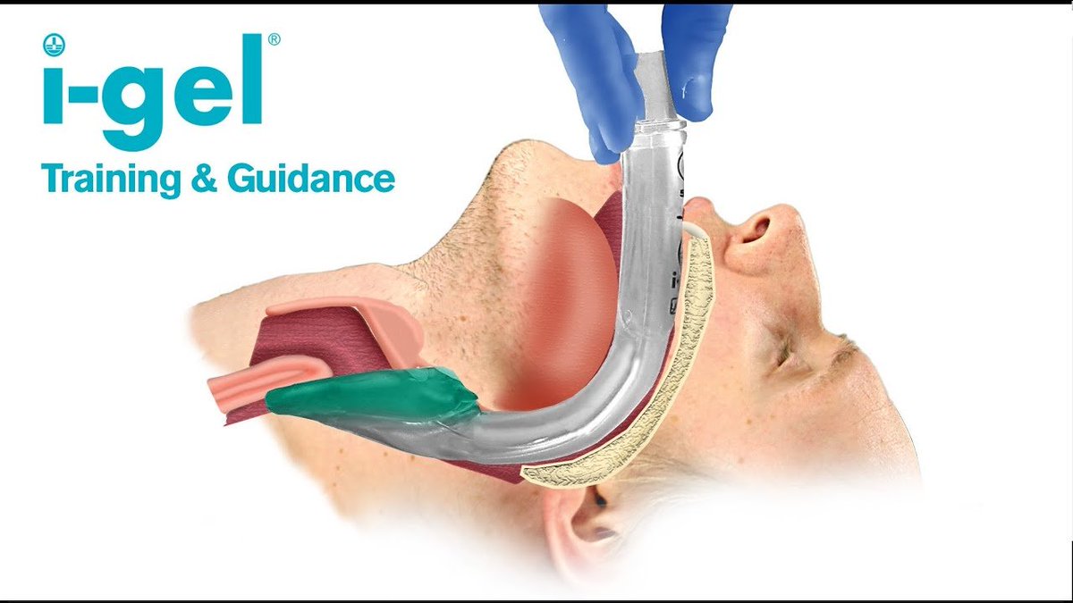 We just made our 6th order of essential medical supplies to Ukraine in the last 4 months!

We're now sending 8 I-gel Airway devices and 4 Bone Injection Guns to the front lines.

This latest order was funded by a bunch of $20 and $100 donations, which is awesome to see! Thanks!