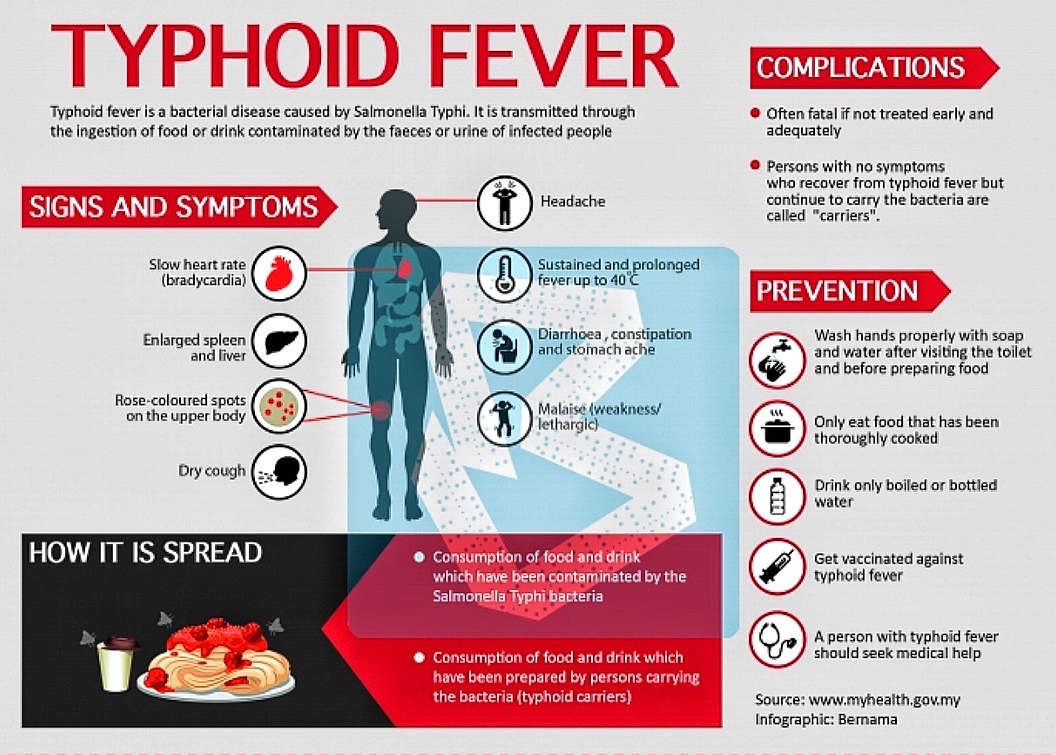 Typhoid/Enteric fever #Bjhm #FOAMed #Salmonella #MedEd #Entericfever #MedTwitter #typhoid #IDtwitter #medicine