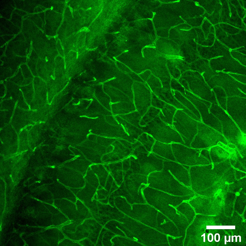 Looking for a fully-funded #PhDposition? Interested in #astrocytes, #epilepsy, #microscopy, and #BBB? Join my lab @DCU @DcuBiotech. Get in touch. Start Sep 2022. Info to follow. Please retweet @FindAPhD @phd_position @Futureneuro_ie @DceeLab #jobfairy #phdfunding #phdscholarship