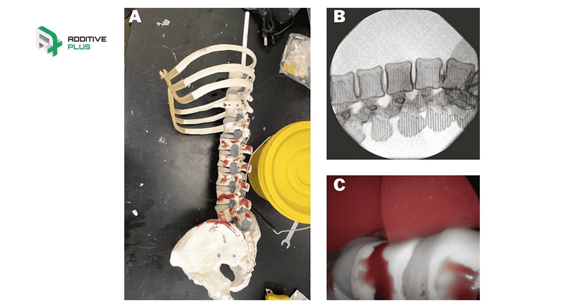 PlusAdditive's tweet image. RESEARCHERS CREATE LOW-COST 3D PRINTED SPINAL SURGICAL MODEL

A group of researchers from the Mayo Clinic, the Georgia Institute of Technology, and the Medical University of South Carolina have 3D printed a low-cost proof-of-concept spinal surgical… t2p.pw/Kut16yYmGL
