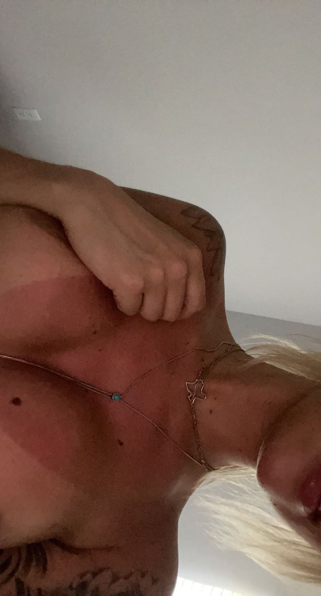 Wear your sunscreen folks 😮‍💨