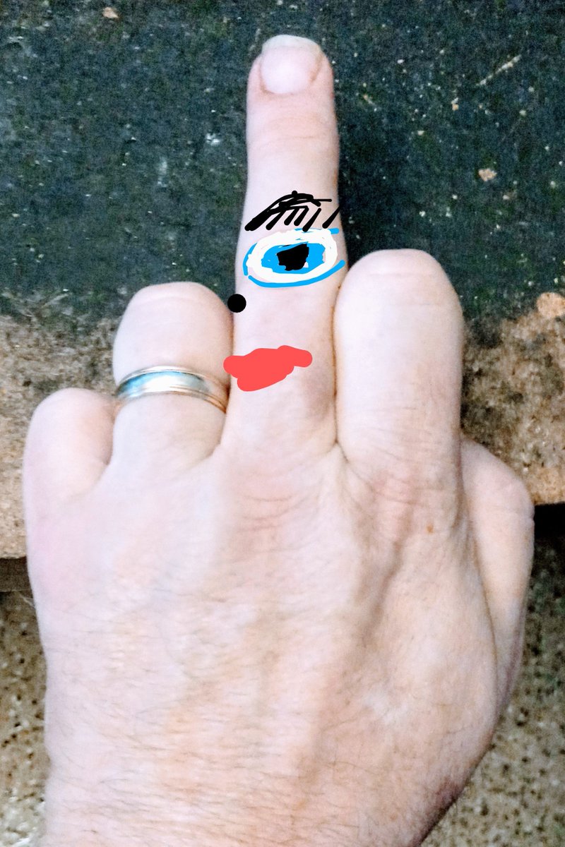 A Southerner might say, "What an interestin' color choice y'all're wearin'."

A New Yorker might say, "Hey, the Renaissance Festival's in town!"

If Mr. Piebald is also from NY he'd laugh, flip the bird, and say, "Yeah! Ya wanna steak-on-a-stick?" Then they'd go get a drink.