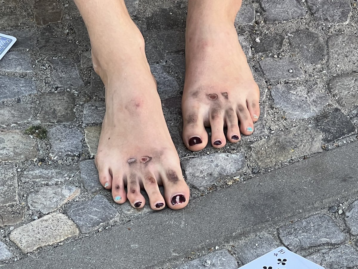 #triggerwarnung #Polizeiproblem #polizeigewalt beim über den Asphalt schleifen gab es an beiden Füßen schürfwunden #Blockade #messedamm #LetzteGeneration #woistolaf noch mehr Videos gibt es hier youtube.com/c/DerPilger1982 ein Video gibt es hier 👇👇 von dem wegschleifen