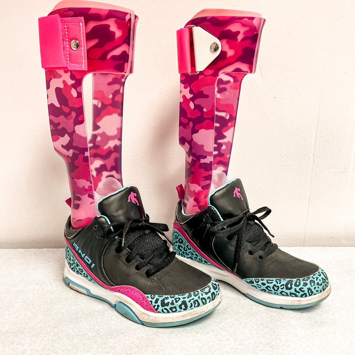 We’re loving how these pink camo AFO’s turned out! Our sweet patient is #prettyinpink heading into the weekend! 💕 #afo #orthotist #oandp #orthopedics #strongkids #littleheros
