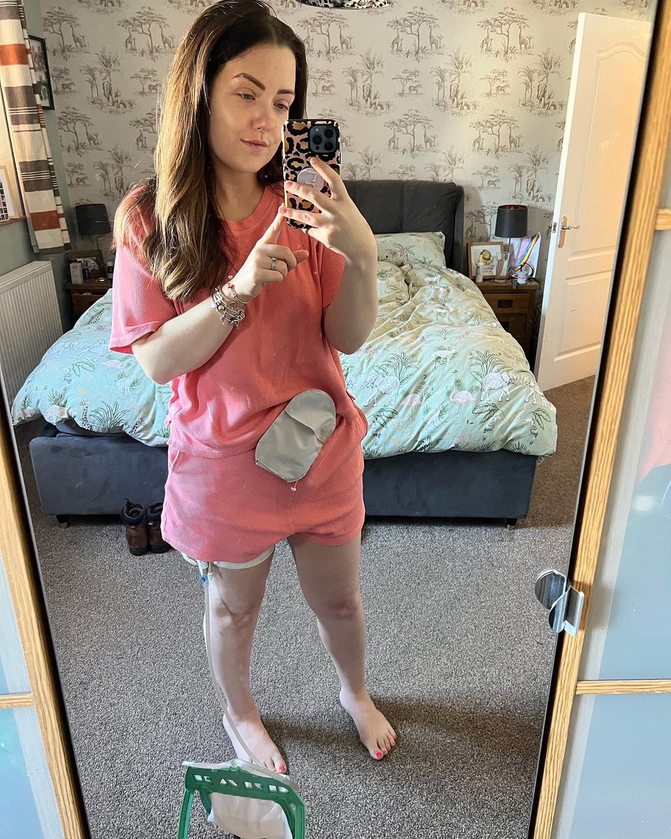 BattleWithEndo's tweet image. Yesterday I was discharged after having a surgery to form a suprapubic catheter. I was given ZERO aftercare advice. Since when is it acceptable to let patients down after having such life altering surgeries. It shouldn’t be up to us to Google our aftercare! #WomensHealthMatters