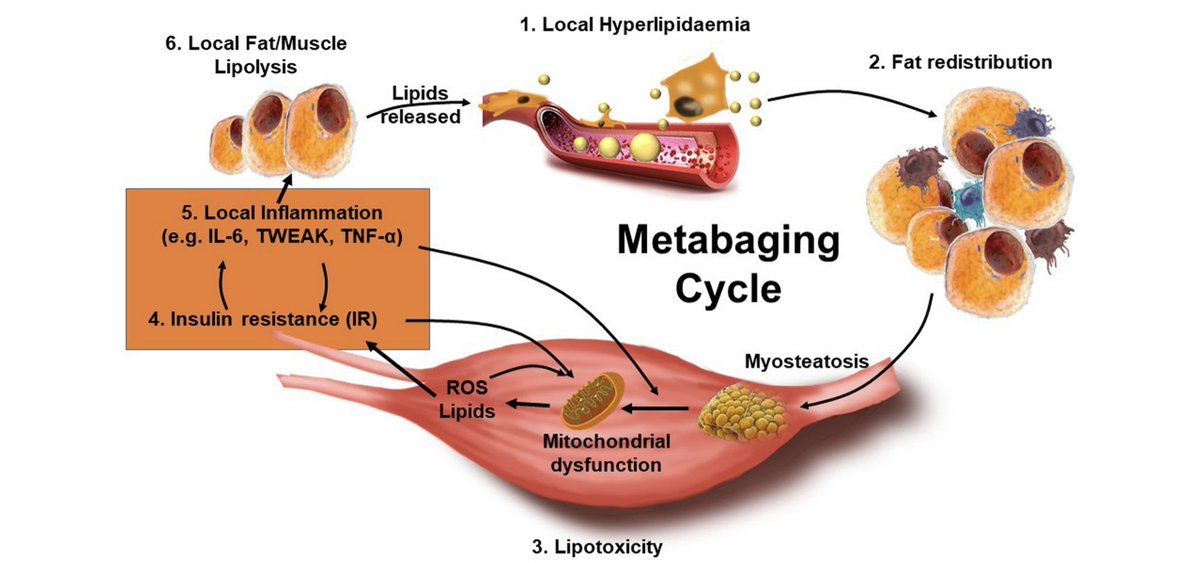 soykarenkruger's tweet photo. La infiltración grasa en la baja masa muscular (Mioesteatosis) provoca una disminución de la fuerza y funcionalidad general, aumentando el riesgo de caídas y fracturas, aumento de la morbilidad y muy pobre calidad de vida
Una razón más para ejercitarte siempre https://t.co/d1Kckrxq4N