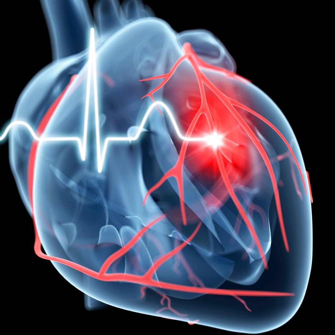 UpToDate's tweet photo. The answer to yesterday's #ClinicalChallenge question is: D. Find out What's New topic in #pulmonary and #CriticalCare. https://t.co/YW7g9GtEYU https://t.co/NuwlQ03888
