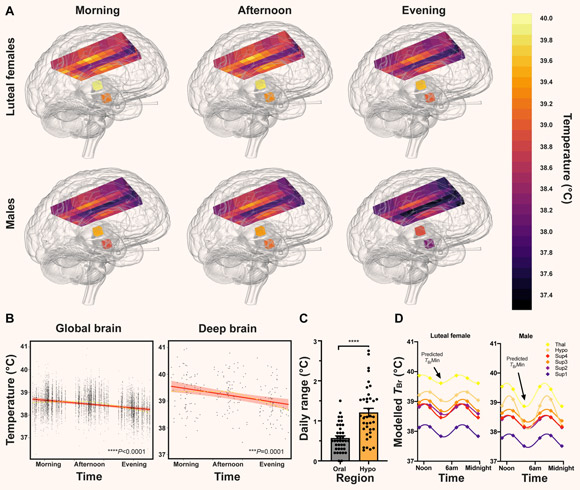 NeurosciTek's tweet photo. Lack of a daily brain temperature rhythm increases the odds of death in intensive care 21-fold.

Human #brain_temperature(36.1 to 40.9°C) is higher and varies more than previously assumed-by #age, #sex, #menstrual_cycle, #brain_region, and #time of day.

https://t.co/M2DifhRgfj https://t.co/v1AmgmZWaZ