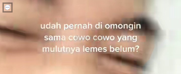 convomfs's tweet photo. 🤍 sender pernah krn gigi sender ga rata:)) https://t.co/0wr00yw2xF