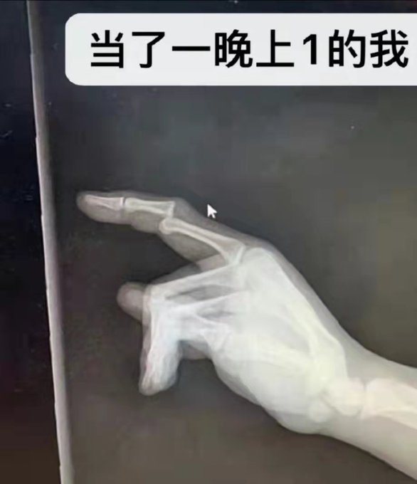 Me after 3 girl/girl scenes 🥹 https://t.co/EKVcnQfIOc