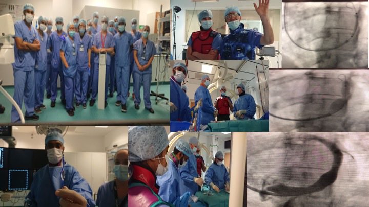 A massive thanks to our Cardiac Angiography Suite Team and AMIIC team for supporting our first case of Coronary Sinus Reducer at the Oxford Heart Centre, for improving treatment of patients with refractory angina. #oxford university #coronary sinus reducer #refractory angina