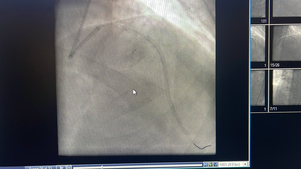 Gianluca Torregrossa tweet media