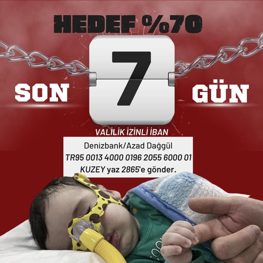 <a href="/kuzeyaliyeumtol/">KUZEY ALİ KAZANDI🍯</a> Bir bebeğin YAŞAMASI parmaklarınızın ucunda lütfen ellerinden tutun ilacına kavuşturalım 

Trump #vakko #ösym #usdtry BDDK Wade
#borsa #dolar