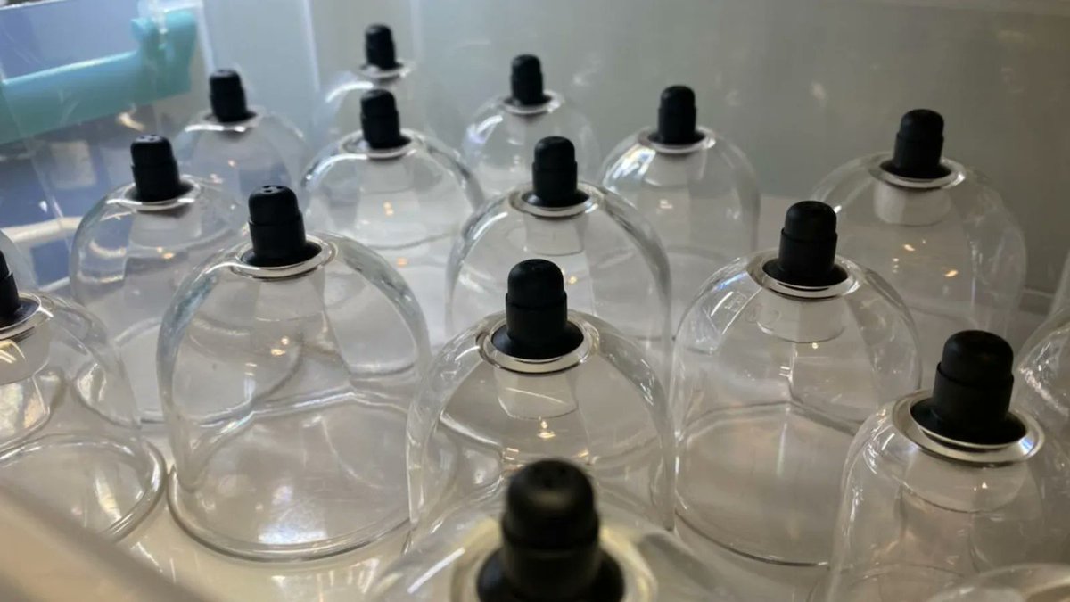 AIHGWellness's tweet photo. Cupping therapy is used to promote blood circulation and remove blockages in the flow of Qi (vital energy). It is often used to complement an acupuncture treatment. 

#AIHGwellness #integrativehealth #Gambrills #Maryland #WaughChapel #massage #tcm #acupuncture #cupping https://t.co/NNAXhFk1hr