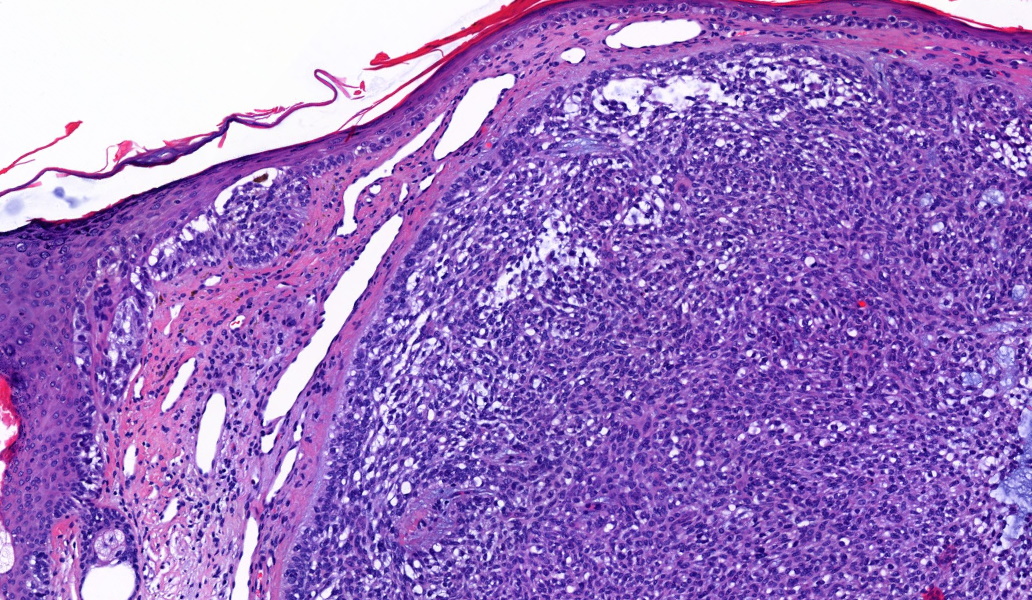 Tim McCalmont tweet media