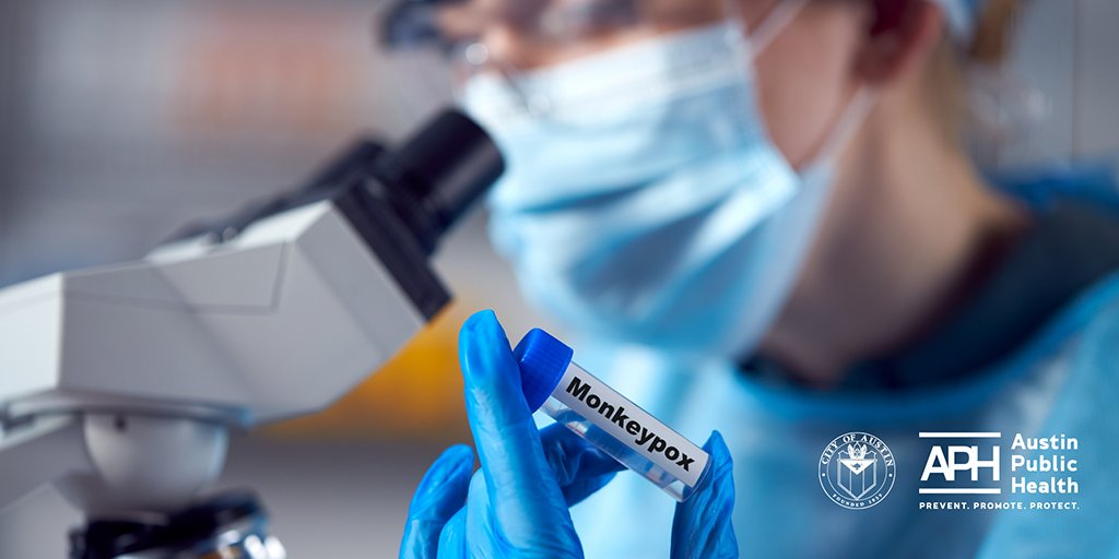 AusPublicHealth's tweet photo. Austin Public Health is investigating a presumptive monkeypox case in Travis County. Monkeypox is rare and does not spread easily between people without close contact. Learn more about prevention and symptoms. https://t.co/buaafCjFJX https://t.co/JNpKKcmPm4
