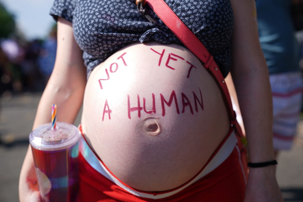 nmasunivision's tweet photo. 🇺🇸 Las clínicas seguirán abiertas: el aborto continuará siendo legal y seguro en Illinois

Más información 👉 https://t.co/mipdb1JiyG. https://t.co/dYxl7F8fM0