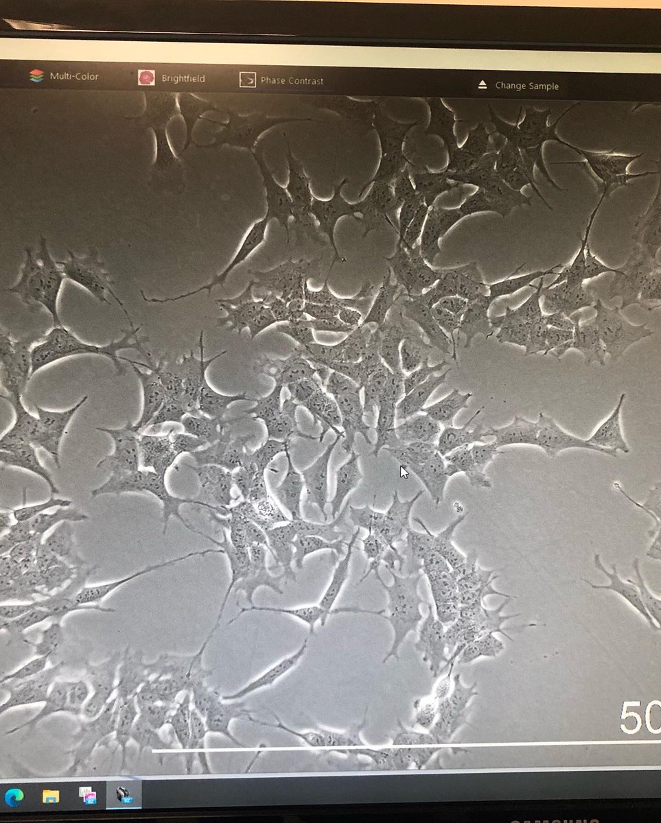 CureKCNH1's tweet photo. Got to tour the lab that’s doing the screening of our ASOs! Very cool to see the actual cell lines that are about to be used to test knockdown of #KCNH1. Huge thanks to @iXCells for hosting us and being so invested in this project!! @PerlaraPBC 
#curekcnh1
#translationalmedicine https://t.co/J0ny5JaBUV