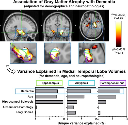 @BrainComms tweet media