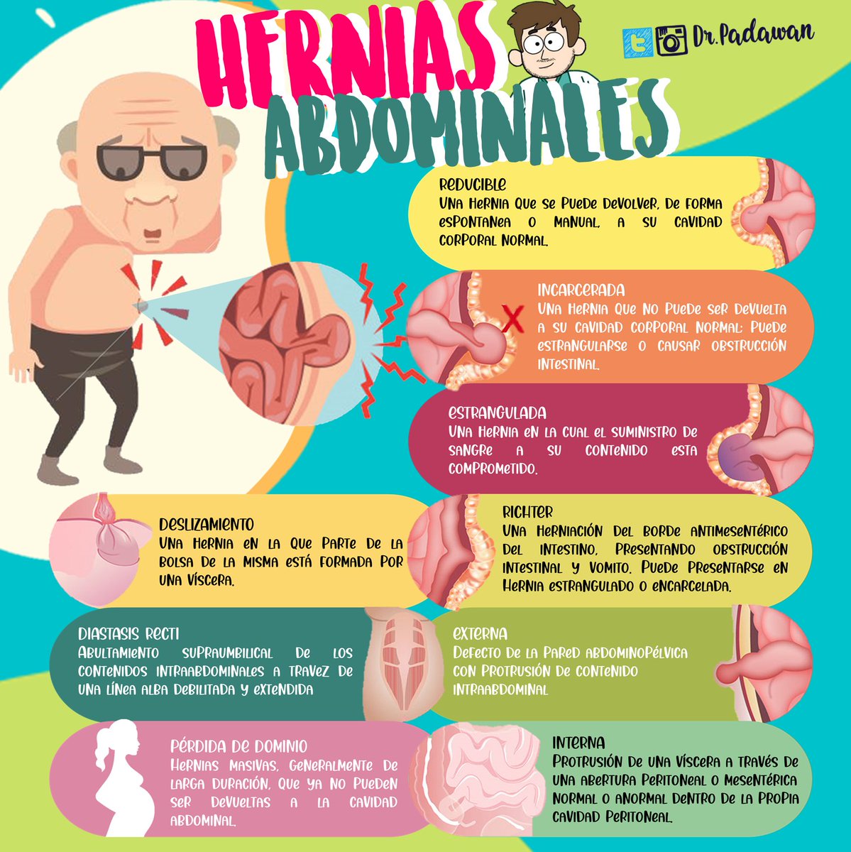 padawan_dr's tweet image. Hernias Abdominales #CirugiaGeneral #ENARM #EGEL #flashcardsmedicina #flashcards #apuntesmedicos #Apuntes #Medicina #rumboalenarm #Abdomen