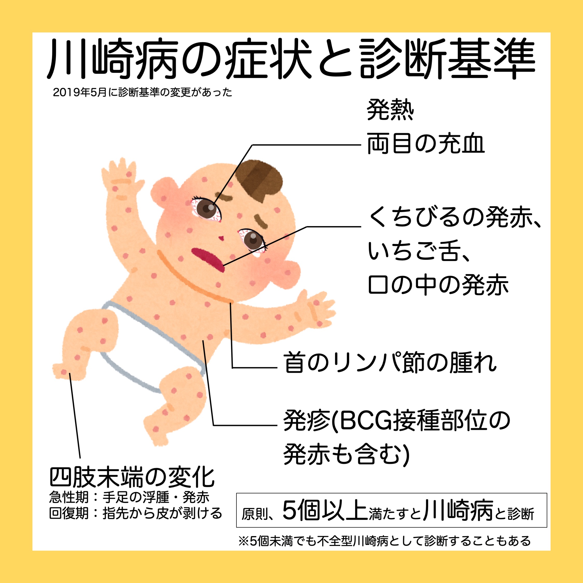 新潟大学医学部小児科学教室 最近県内の 川崎病 の入院が目立ちます 川崎病は最初は風邪にしか見えないことがありますが 発熱が続き 徐々に発熱以外の症状 目の充血 発疹 くちびるの発赤などなど が揃ってきて 遅れて診断されます 発熱が5日以上続く