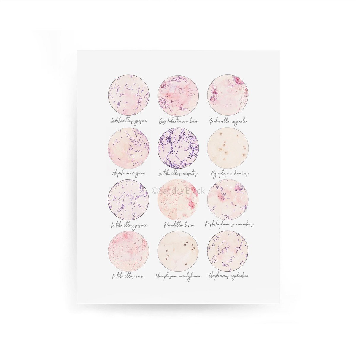 sandrablackart's tweet photo. A new print in from my #etsy shop: Vaginal Microbes. #microbiology #sciart https://t.co/7Fe071ND32 https://t.co/tfRwx28Bp8