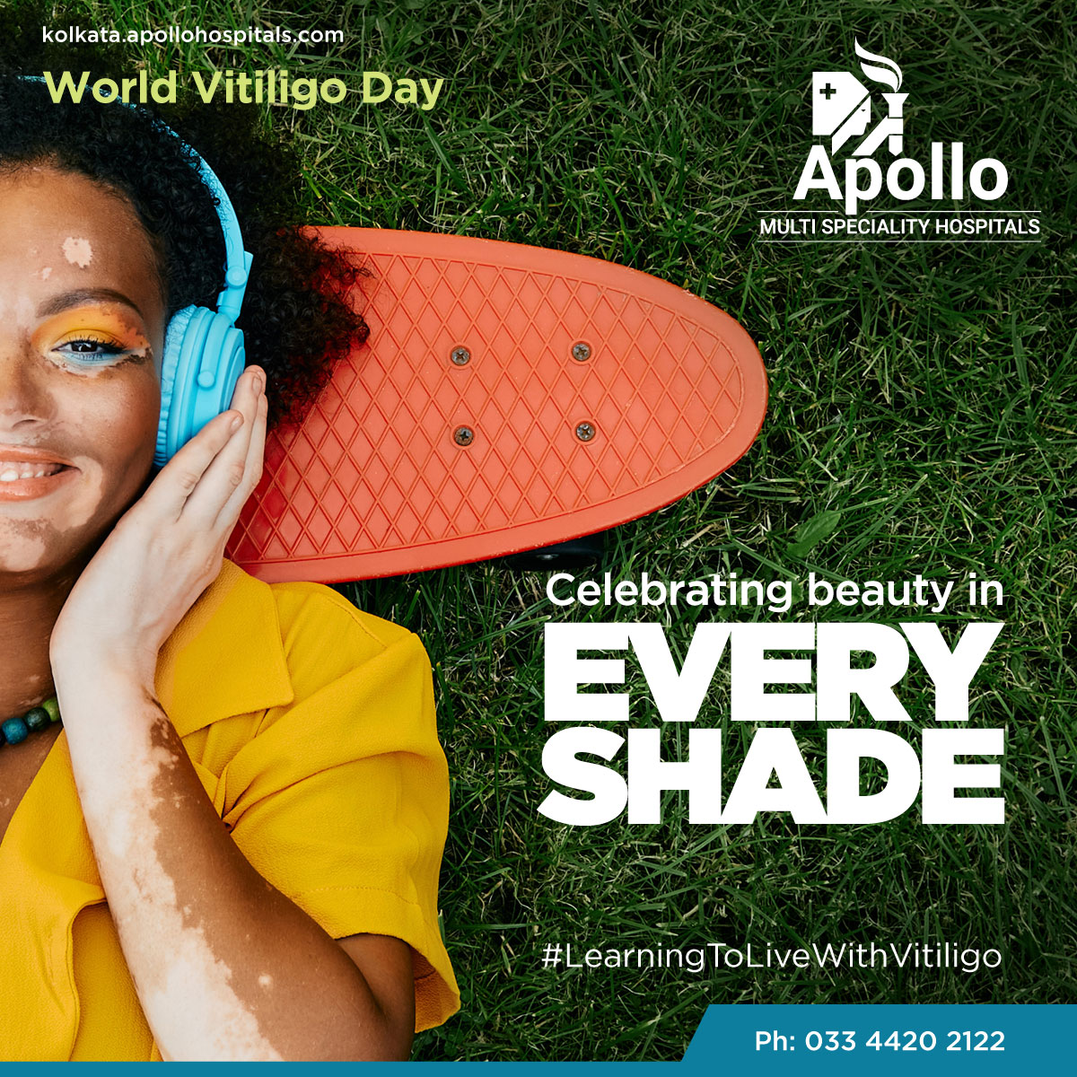 apollo_kolkata's tweet photo. Vitiligo is a skin disease which occurs due to the lack of a pigment in the skin. In this skin disease, there is a loss of skin colour in patches.
#worldvitiligoday #vitiligo #medsolutions #healthcare #kolkata https://t.co/rA4ZeSdgX0
