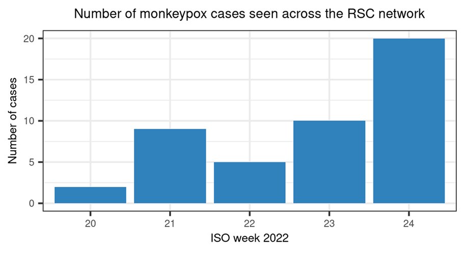 Simon de Lusignan (@lusignan_s) on Twitter photo Monkey pox, RSC general practices shows what's happening. 45 cases detected in our network <a href="/ORCHID_Oxford/">ORCHID</a> @RCGP we work closely with <a href="/UKHSA/">UK Health Security Agency</a> Thanks to public & member practices for sharing data, "Coding is Caring!" Please code this, small pox vaccination, & all acute infections. Monkey pox, RSC general practices shows what's happening. 45 cases detected in our network <a href="/ORCHID_Oxford/">ORCHID</a> @RCGP we work closely with <a href="/UKHSA/">UK Health Security Agency</a> Thanks to public & member practices for sharing data, "Coding is Caring!" Please code this, small pox vaccination, & all acute infections.