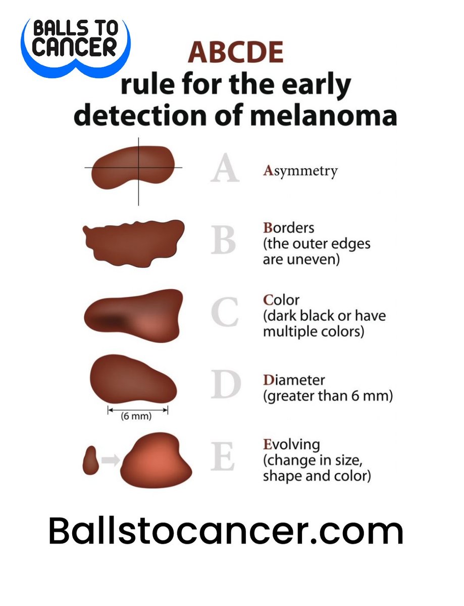 Ballstocancer's tweet photo. It's a #SkinCancer Saturday. Some people don't understand why we ask you to check your skin and why we ask you to cover up in the sun and avoid sunbeds. We do it because skin cancer is rising up that list of cancers as most common killers https://t.co/K5yJQUB4H1 please share 🙏 https://t.co/PUcrAdkE6b