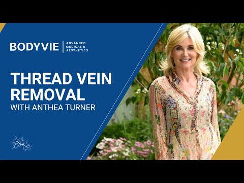 Anthea Turner Talks About Thread Vein Removal - Bodyvie