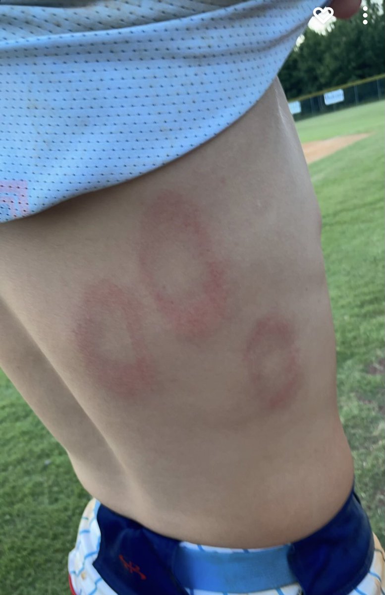 Reached base 7/8 at bats in two games last night. Results of first three at bats. #wearit