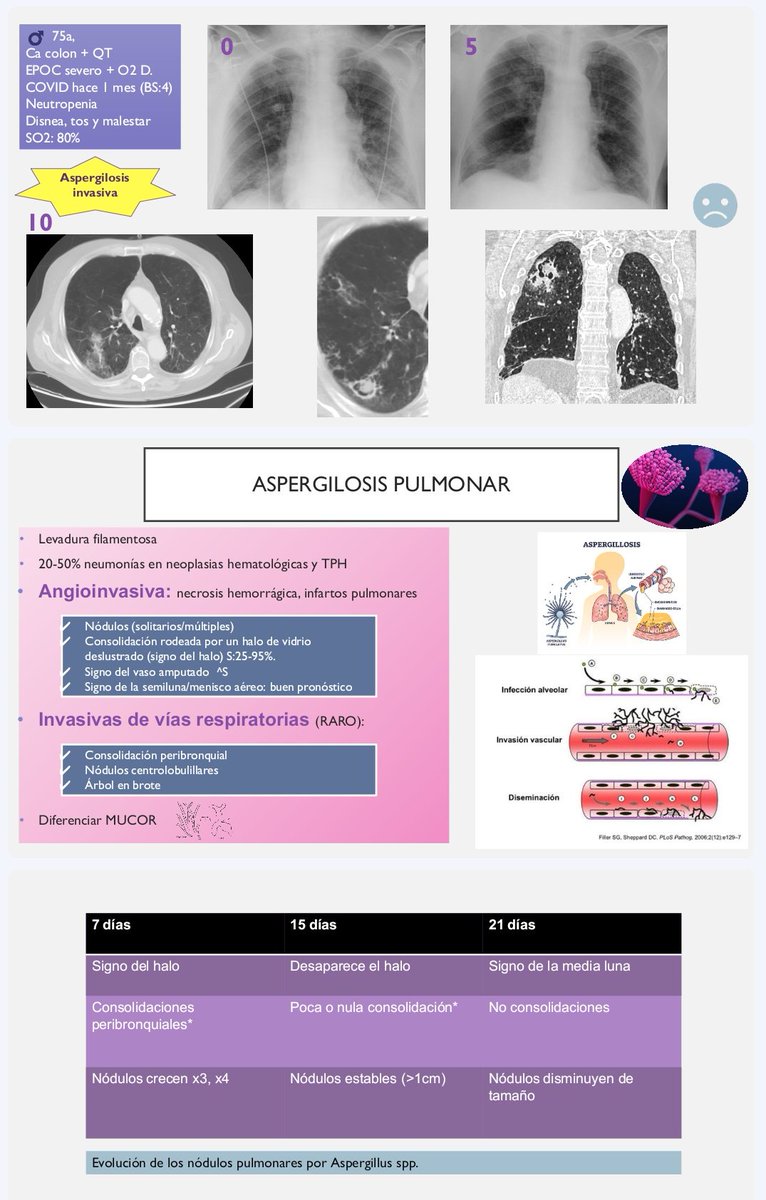 serammeA6SALUD's tweet photo. Enhorabuena a nuestra residente Estefanía Cotillo por su primera sesión monográfica en el Servicio:
Neumonías en pacientes inmunocomprometidos. https://t.co/h2MkYb61lc