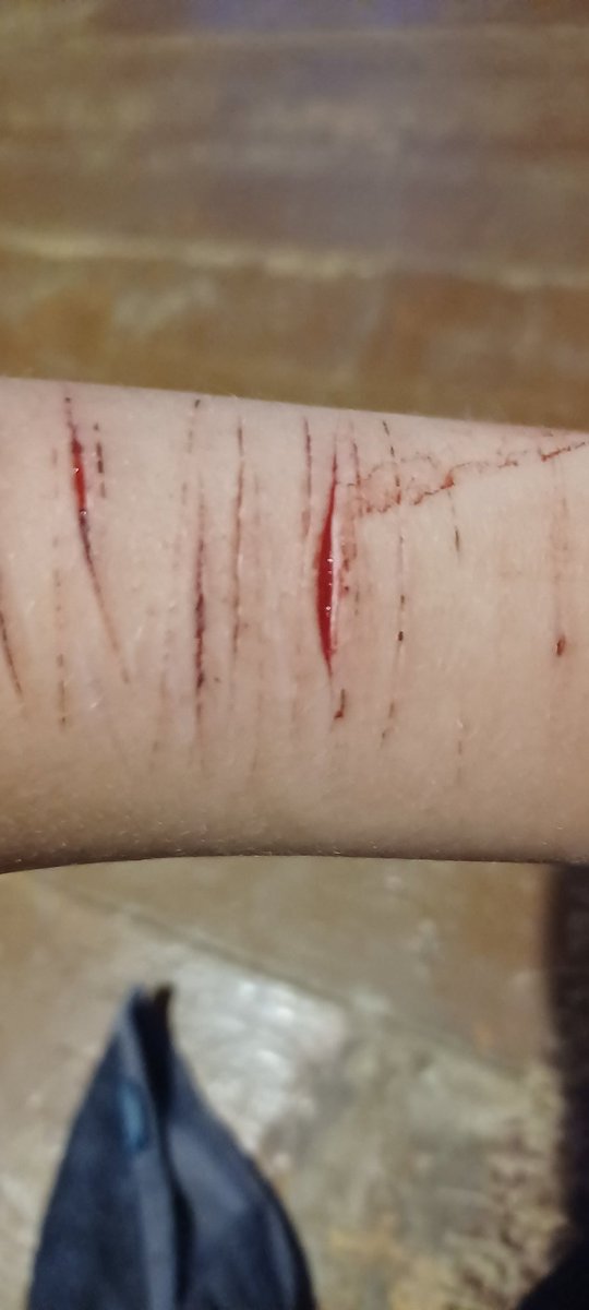 LEE90854662's tweet photo. Tw: self harm, shtwt, styro, styrotwt, cuts, blood
.
.
.
I keep seeing videos of people cutting, and like- why yall swipe so fats???😭😭 bc im just slowly going over the skin, ive never seen any1 else do that
( here are some more old styro cuts lol ) https://t.co/wxIKMwVXLb