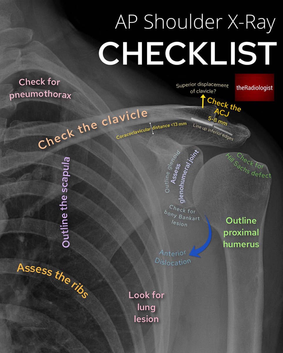 theRadiologist on Twitter "AP shoulder Xray checklist"