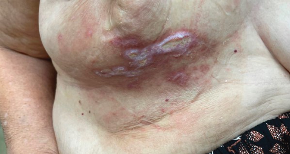 Advances in Skin & Wound Care tweet media