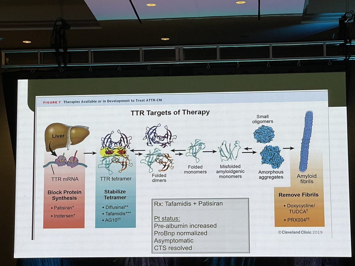 Sonali Kumar Sharma, MD (@sonalikumarmd) on Twitter photo Fantastic talk on cardiac amyloidosis by Dr. Egolum <a href="/ngmcHFdoc/">Ugo O. Egolum, MD FACC (🇺🇸🇯🇲🇳🇬)</a>, highlighting that ATTR-CM is fatal and frequently misdiagnosed. Prompt recognition of red flags and subsequent diagnosis with monoclonal protein followed by scintigraphy or biopsy is paramount! <a href="/GaHeart_NGHS/">Georgia Heart Institute</a> Fantastic talk on cardiac amyloidosis by Dr. Egolum <a href="/ngmcHFdoc/">Ugo O. Egolum, MD FACC (🇺🇸🇯🇲🇳🇬)</a>, highlighting that ATTR-CM is fatal and frequently misdiagnosed. Prompt recognition of red flags and subsequent diagnosis with monoclonal protein followed by scintigraphy or biopsy is paramount! <a href="/GaHeart_NGHS/">Georgia Heart Institute</a>