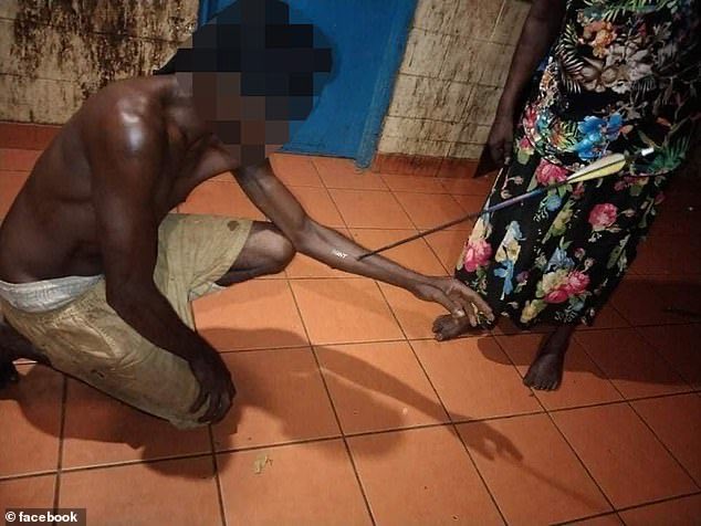 TheNorskaPaul's tweet photo. Pics show men with ARROWS pierced through their arms & legs after 20 crossbows were stolen &used in a fight in #Wadeye #NorthernTerritory #Australia
They were stolen from #MitchellsAdventures #Darwin & remote #Aboriginal community has been marred with violence in recent months. https://t.co/xLOBJvlMSD