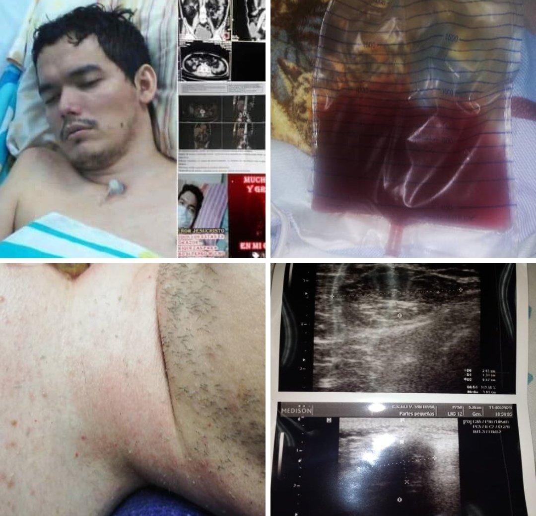PERIODICOELPEN1's tweet photo. @LassoGuillermo FELICITACIONES PRESIDENTE @LassoGuillermo. LE PEDIMOS TAMBIÉN RECORDAR A @ANDRESCEVALLO1 JOVEN Q ESTÁ 18 AÑIS EN XAMA VÍCTIMA DE 5 NEGLIG DEL @Salud_Ec CON SENTENCIA @CorteConstEcu.A QUIEN UD VISITO CON SU ESPOSA @MLAlcivar Y LE PROMETIO AYUDA  PERO LE LLEGA SU OFRECIDO APOYO SOS https://t.co/hIWg4DuqmI