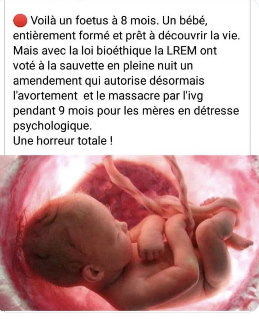 NellyCaminade's tweet photo. @E_DupondM @auroreberge @RixainMP Le pire de notre société ⬇️ https://t.co/nW2h4NQ3mk