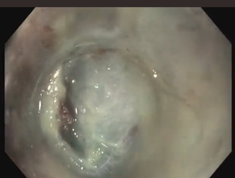 Mohammad Bilal, MD tweet media