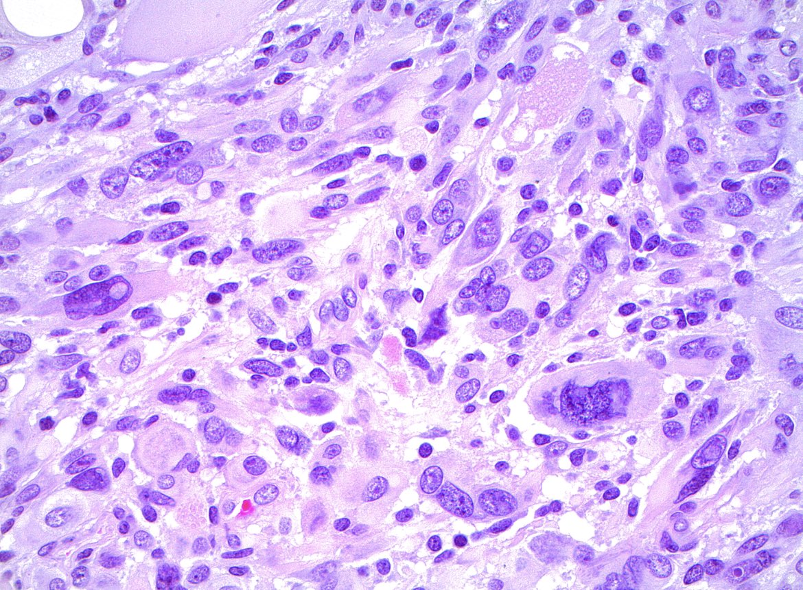 Jared T. Ahrendsen MD, PhD (AP/NP/FP) tweet media