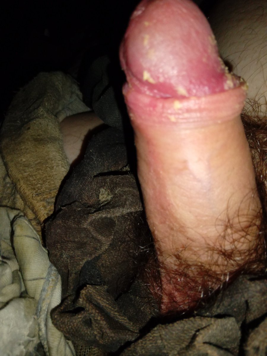 cheese_chub's tweet photo. #smegma #chub #gaychub #raunch #cheesecock #smellysocks https://t.co/OCI0ixSMId