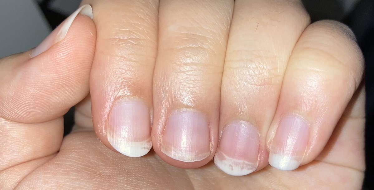 boobillee's tweet photo. my nails r so sus LMFAO https://t.co/iLRRahsZ43