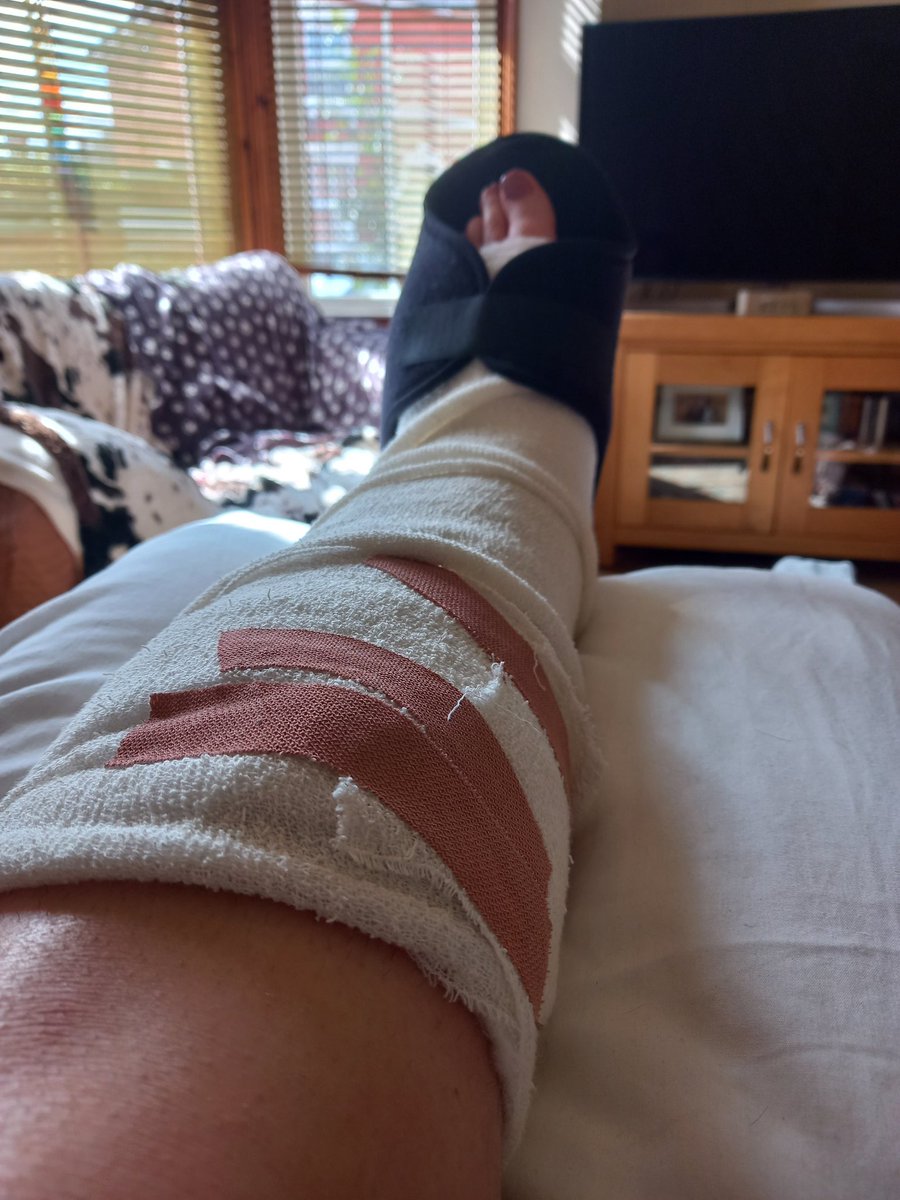Thanks to everyone <a href="/WyeValleyNHS/">Wye Valley NHS Trust</a> for putting my leg back together.  You were all superstars xx