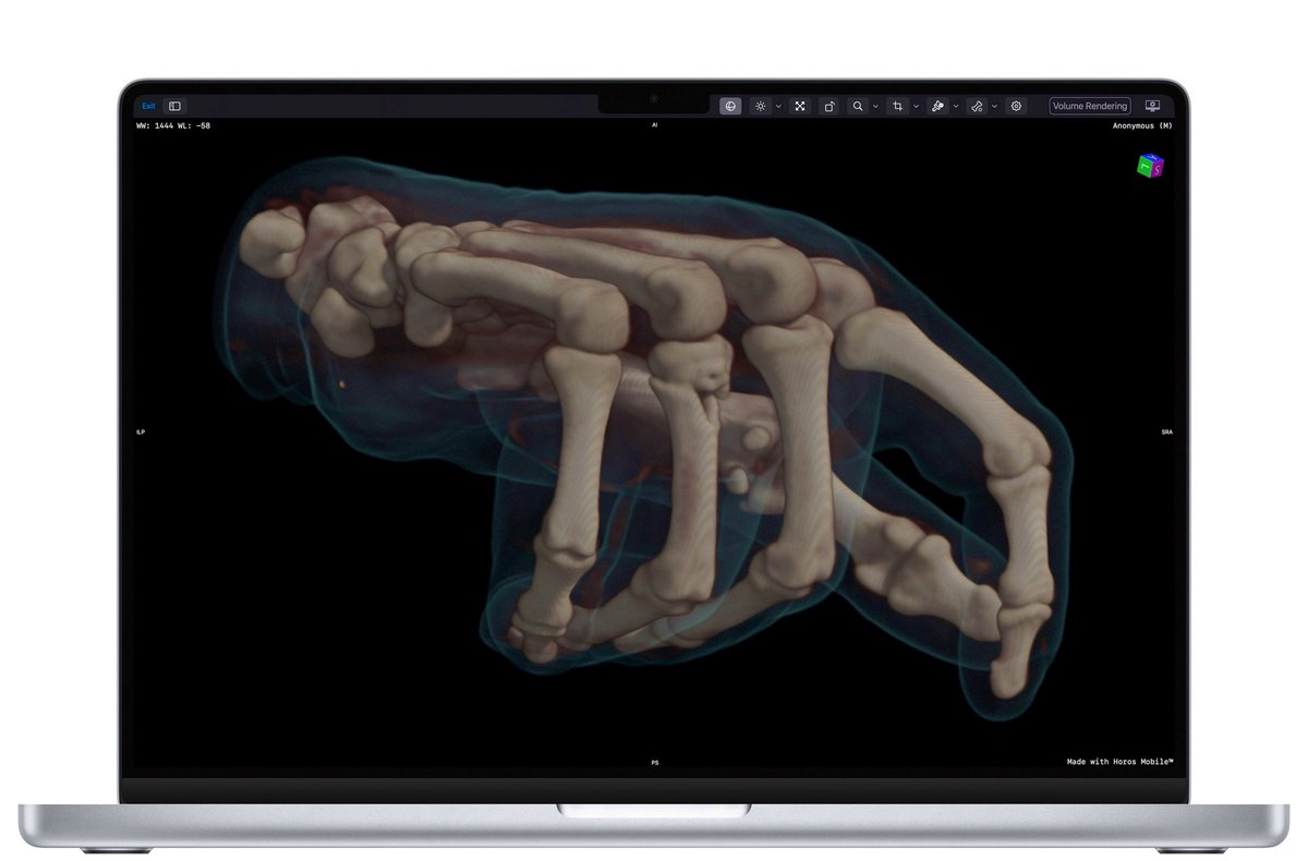 Horos Mobile™ tweet media