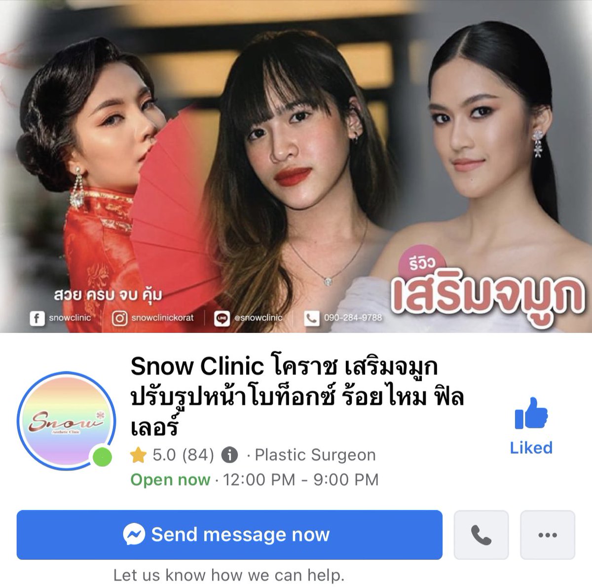 BrightMinho's tweet photo. แปะคลินิกที่เราทำน้าาา 
อันนี้ที่ Snow Clinic เซฟวันโคราช
ทำโดยคุณหมอคิตตี้ เสียงคลิปด้านบนเลย

Line ID : @snowclinic (มี @ )
https://t.co/42t22hN61b

ส่วนสำหรับใครอยู่จังหวัดอื่น ลองหาดูรีวิวดูนะครับ เอาชื่อคลินิกไปเช็กกับเว็บไซต์ที่นำฟิลเลอร์/โบท็อกซ์เข้าด้วย จะได้รู้ว่าแท้มั้ย https://t.co/uXr8OaYi7n