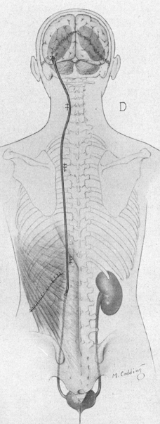 The Brigham Neurosurgery Residents tweet media